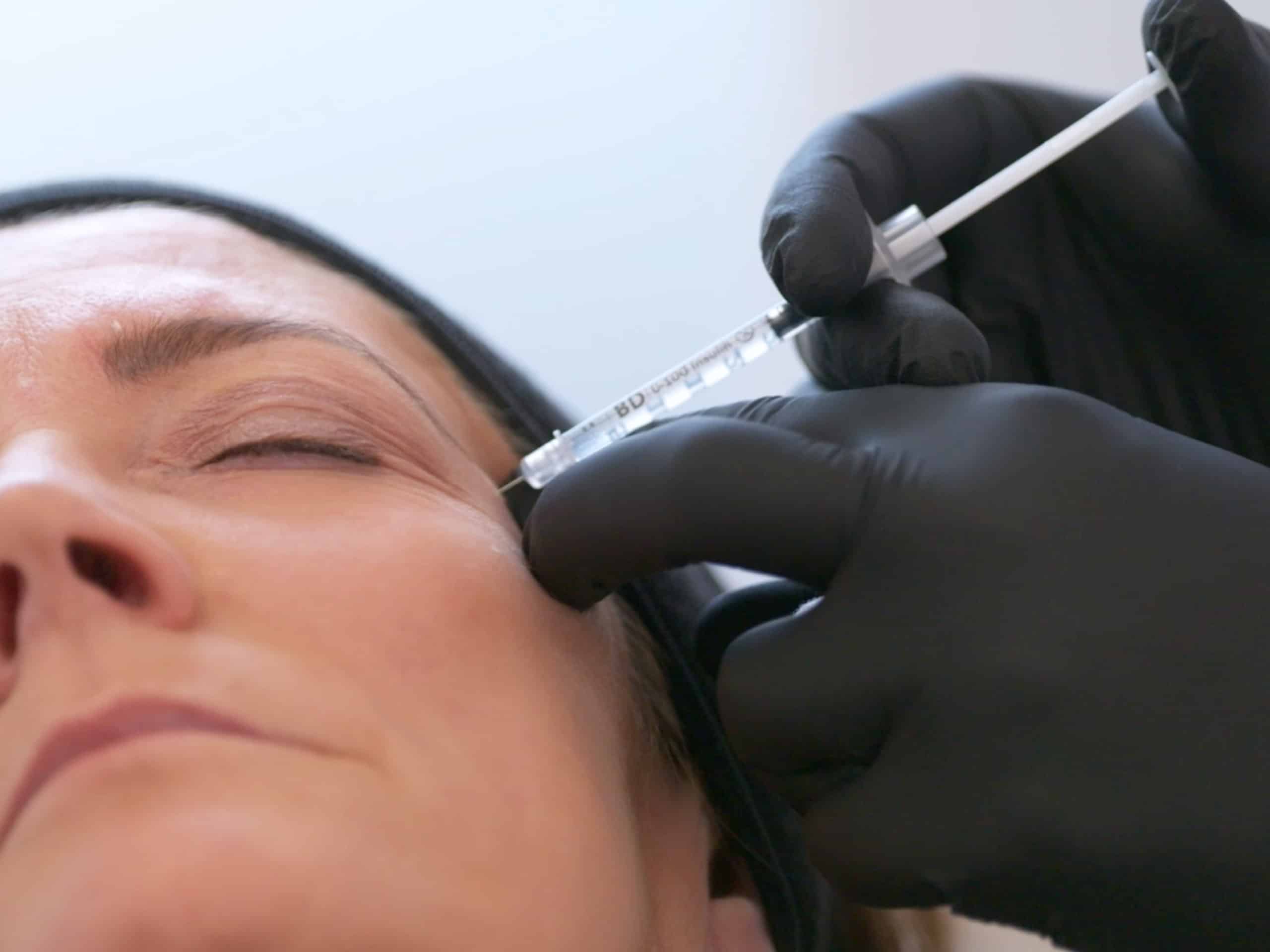 botox in chelsea