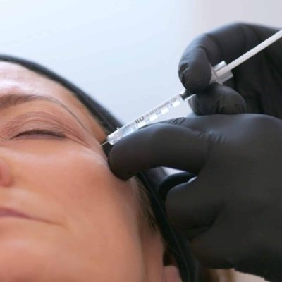 botox in chelsea